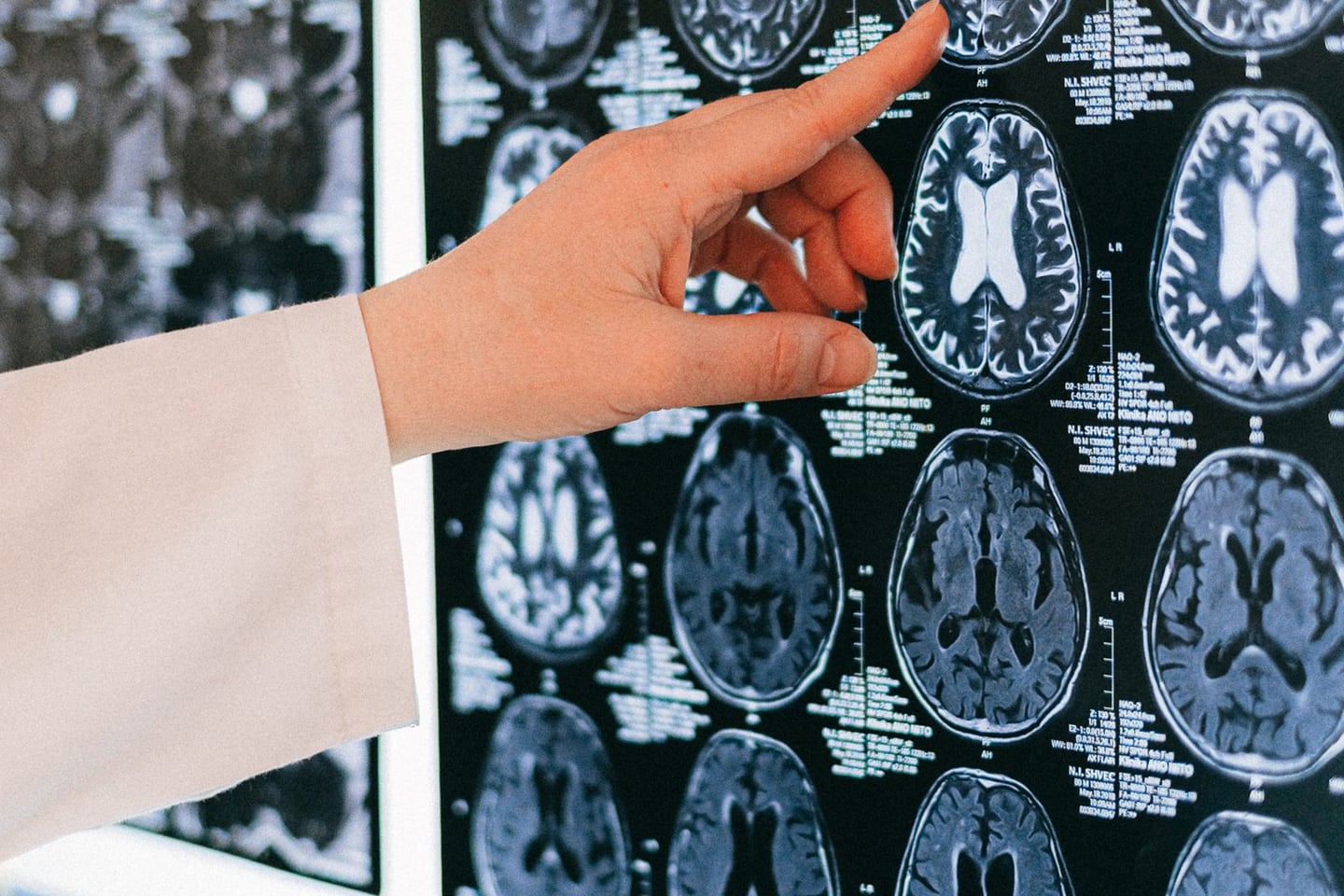 Medical imaging and brain research