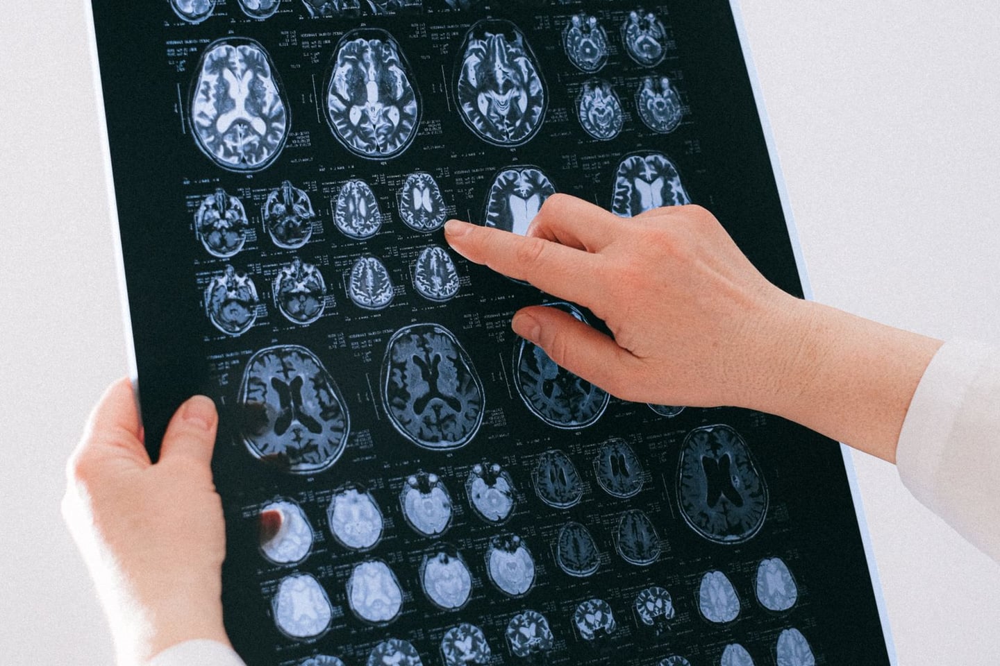 Medical imaging and brain research