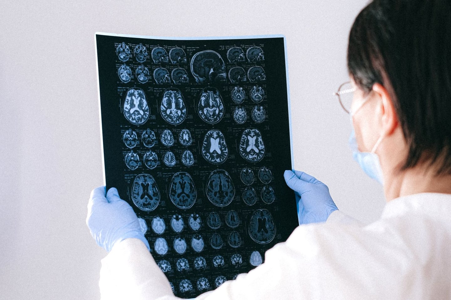 Medical imaging and brain research
