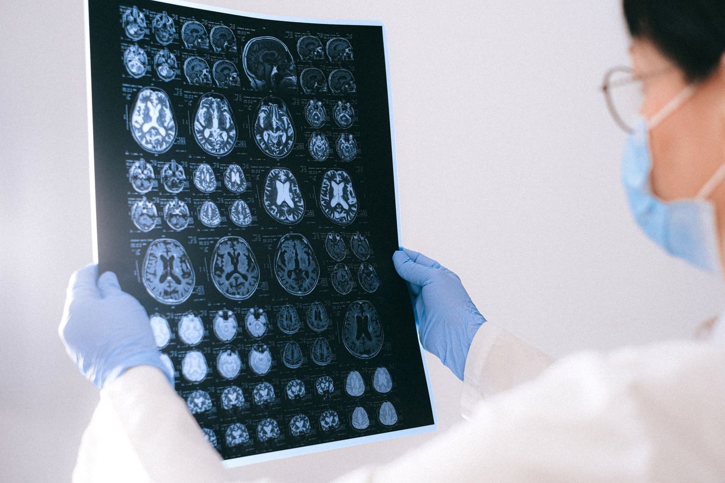 Medical imaging and brain research