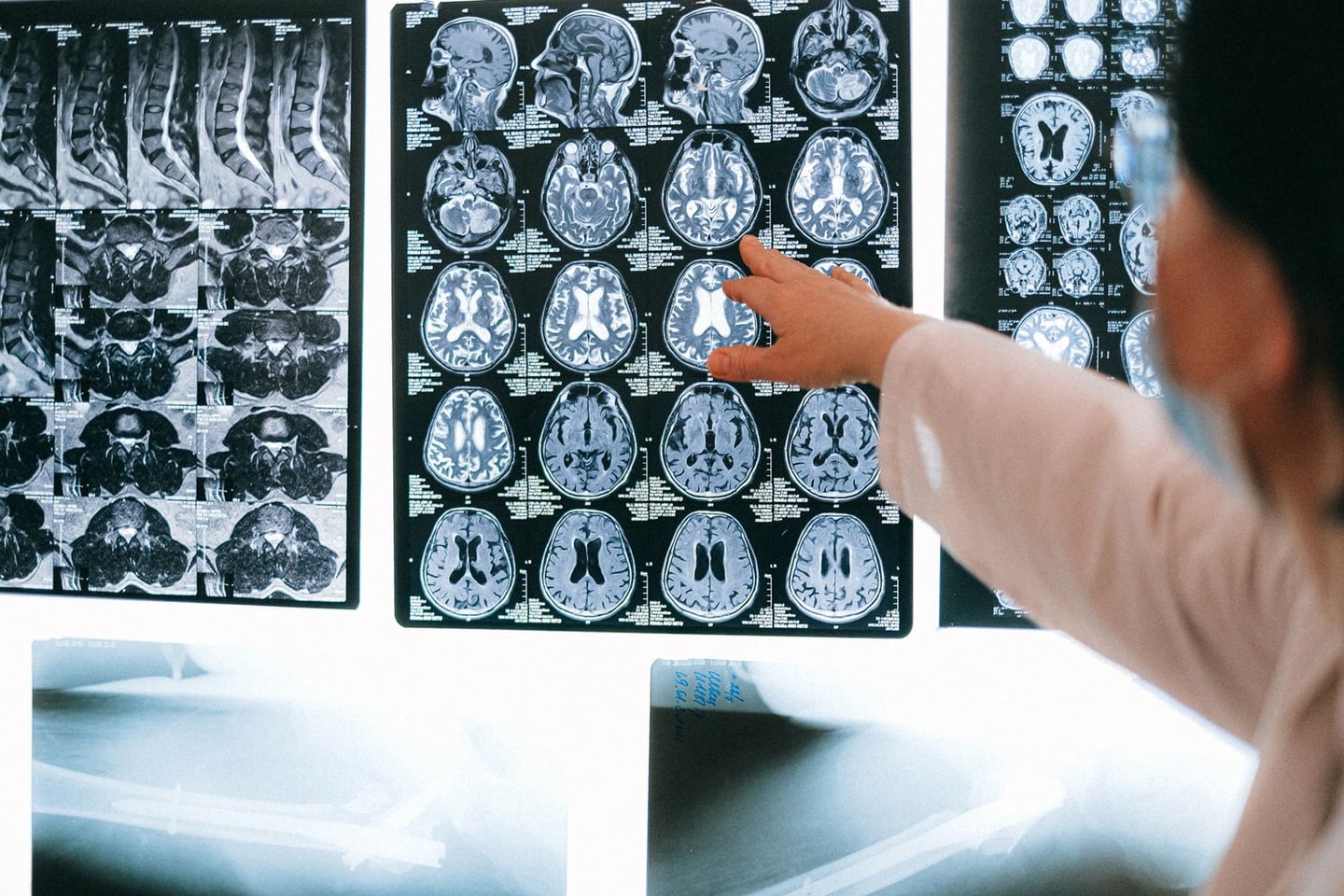 Medical imaging and brain research