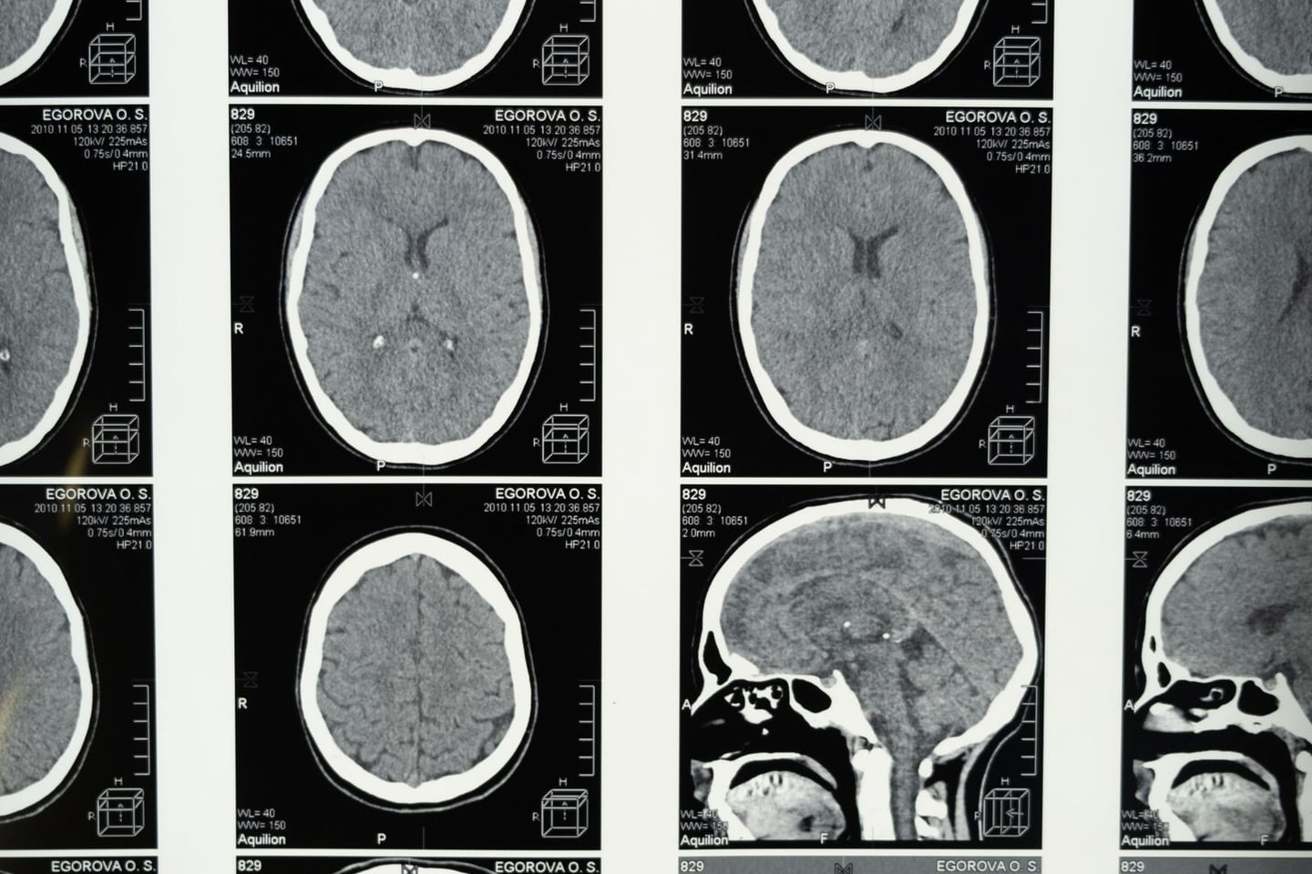 Medical imaging and brain research