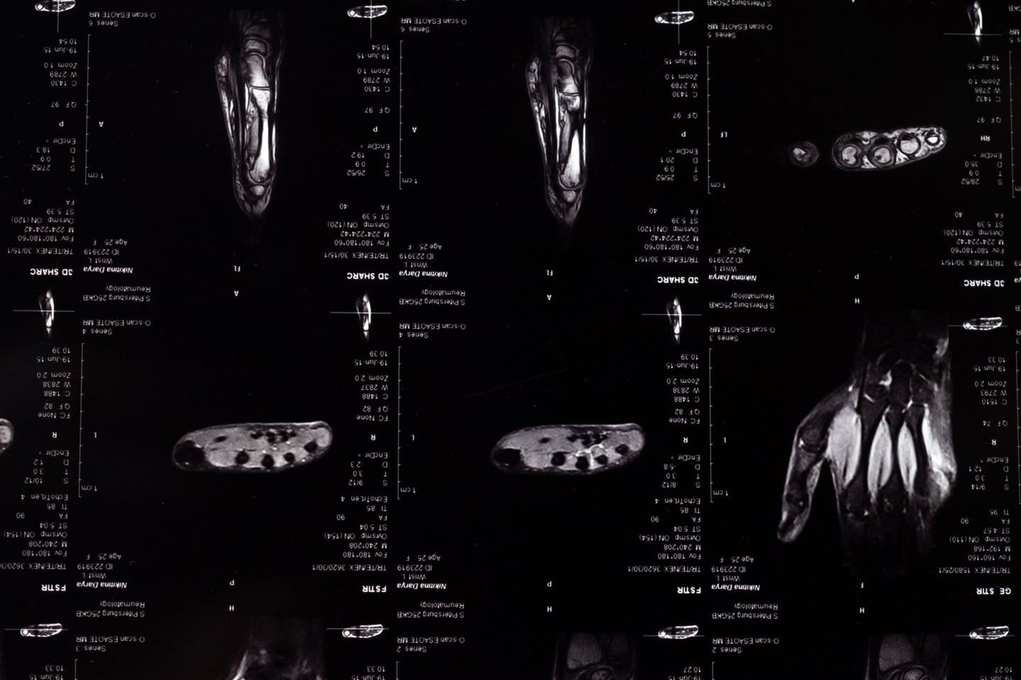 Medical imaging and brain research
