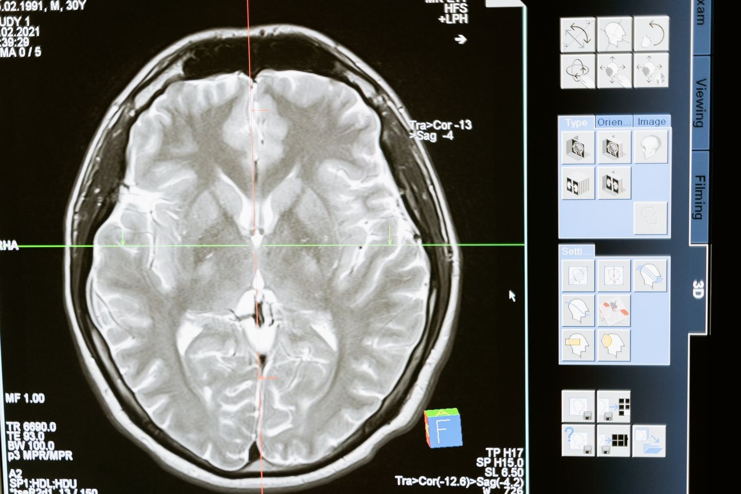 Medical imaging and brain research
