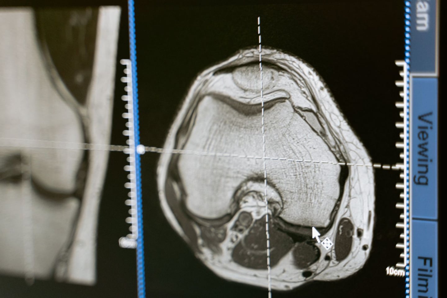 Medical imaging and brain research